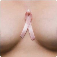 Krūties vėžys - dažniausia moterų onkologinė liga pasaulyje